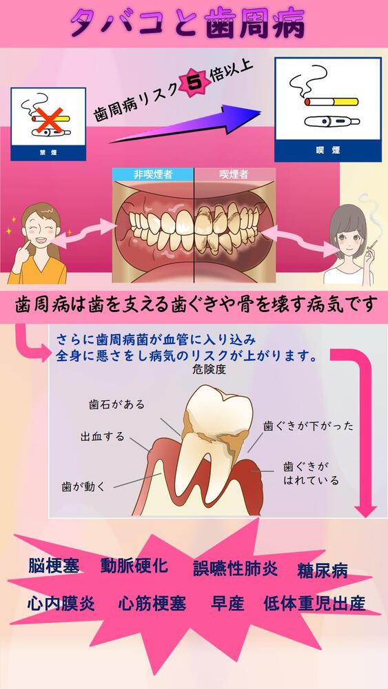 タバコと歯周病の図1ページめ